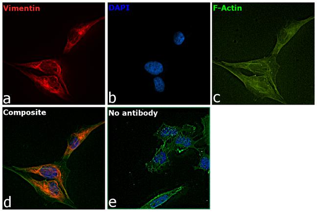 Vimentin Antibody in Immunocytochemistry (ICC/IF)