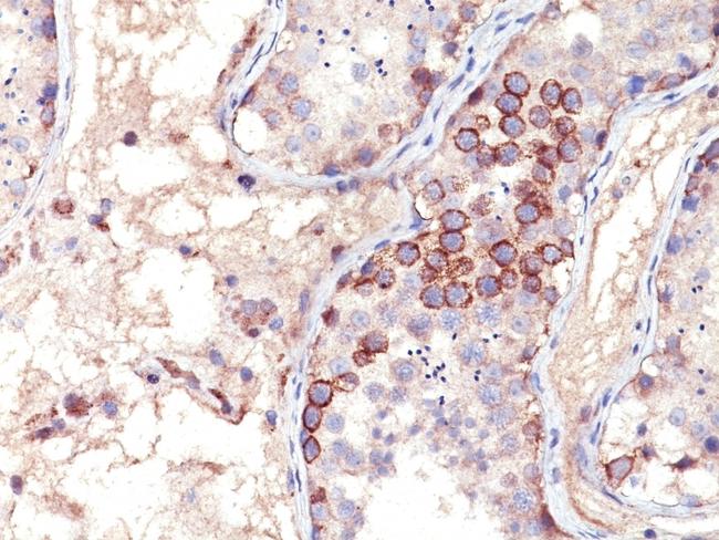 MAGE-1 (Target for Cancer Immunotherapy) Antibody in Immunohistochemistry (Paraffin) (IHC (P))