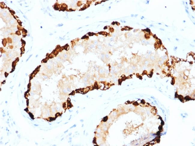 Melanoma Antigen Family A, 4/MAGEA4 Antibody in Immunohistochemistry (Paraffin) (IHC (P))