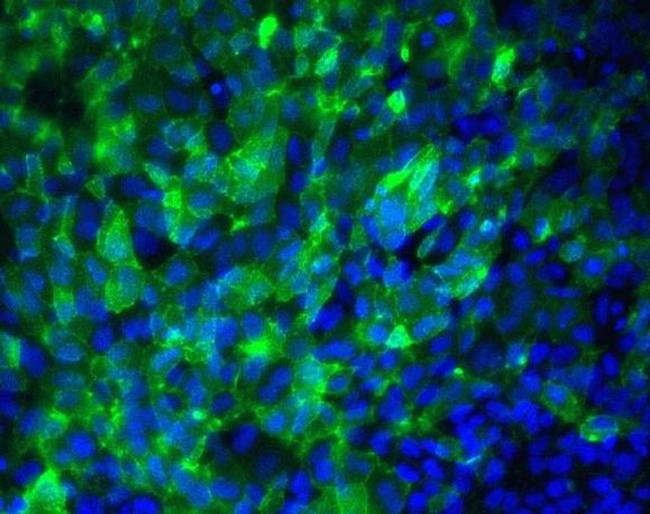 TRA-1-60 Antibody in Immunocytochemistry (ICC/IF)