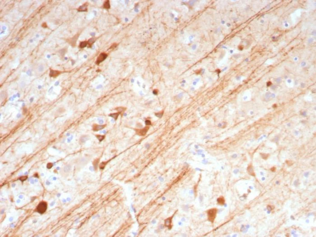 MAP2 Antibody in Immunohistochemistry (Paraffin) (IHC (P))