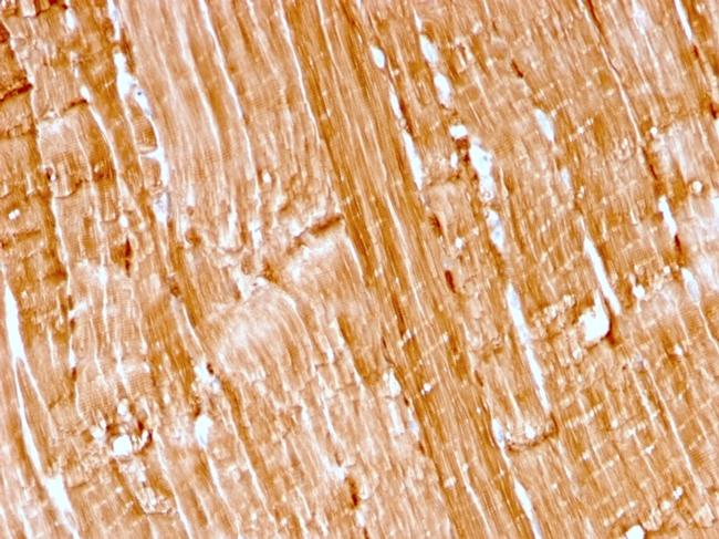 Myoglobin Antibody in Immunohistochemistry (Paraffin) (IHC (P))