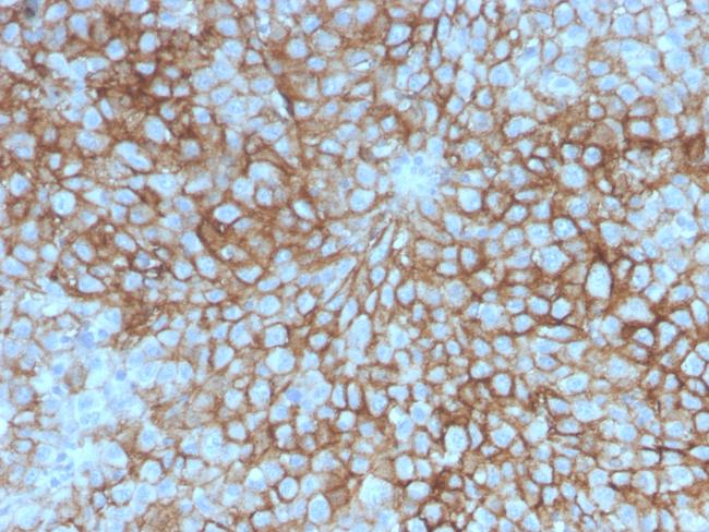 MUC18/CD146/MCAM (Melanoma Cell Adhesion Molecule) Antibody in Immunohistochemistry (Paraffin) (IHC (P))