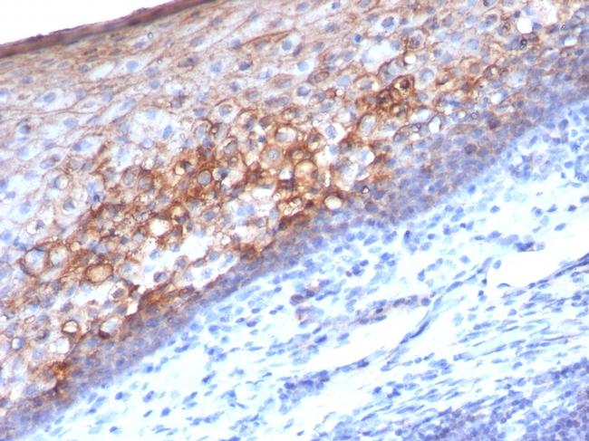 MCAM (Melanoma Cell Adhesion Molecule)/MUC18/CD146 Antibody in Immunohistochemistry (Paraffin) (IHC (P))