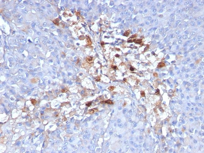 MCAM (Melanoma Cell Adhesion Molecule)/MUC18/CD146 Antibody in Immunohistochemistry (Paraffin) (IHC (P))