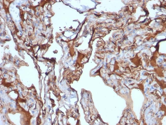 MCAM (Melanoma Cell Adhesion Molecule)/MUC18/CD146 Antibody in Immunohistochemistry (Paraffin) (IHC (P))