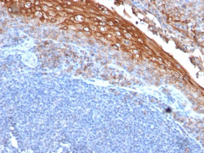 MCAM (Melanoma Cell Adhesion Molecule)/MUC18/CD146 Antibody in Immunohistochemistry (Paraffin) (IHC (P))