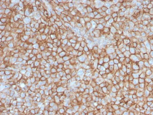 MCAM (Melanoma Cell Adhesion Molecule)/MUC18/CD146 Antibody in Immunohistochemistry (Paraffin) (IHC (P))