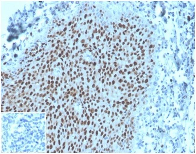 MCM2 (ProliferationMarker) Antibody in Immunohistochemistry (Paraffin) (IHC (P))