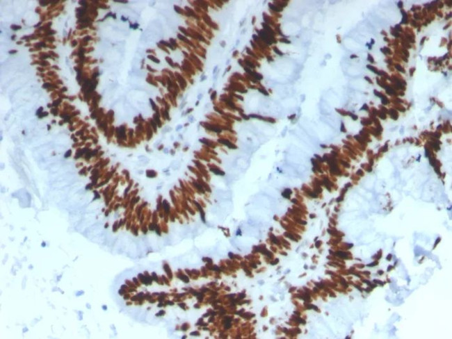 MCM3 (Proliferation Marker) Antibody in Immunohistochemistry (Paraffin) (IHC (P))