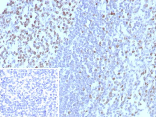 MCM3 (Proliferation Marker) Antibody in Immunohistochemistry (Paraffin) (IHC (P))