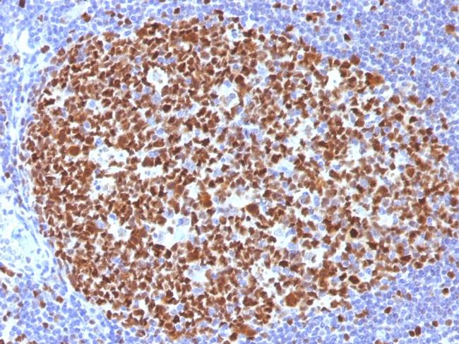 MCM7 Antibody in Immunohistochemistry (Paraffin) (IHC (P))