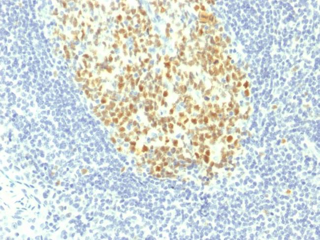 MCM7 (Proliferation Marker) Antibody in Immunohistochemistry (Paraffin) (IHC (P))