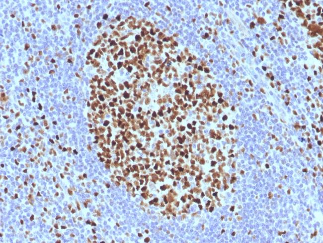 MCM7/CDC47 (Proliferation Marker) Antibody in Immunohistochemistry (Paraffin) (IHC (P))