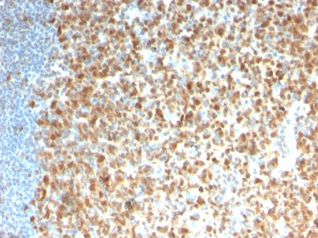 MCM7 Antibody in Immunohistochemistry (Paraffin) (IHC (P))