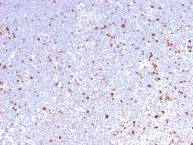 MCM7 Antibody in Immunohistochemistry (Paraffin) (IHC (P))