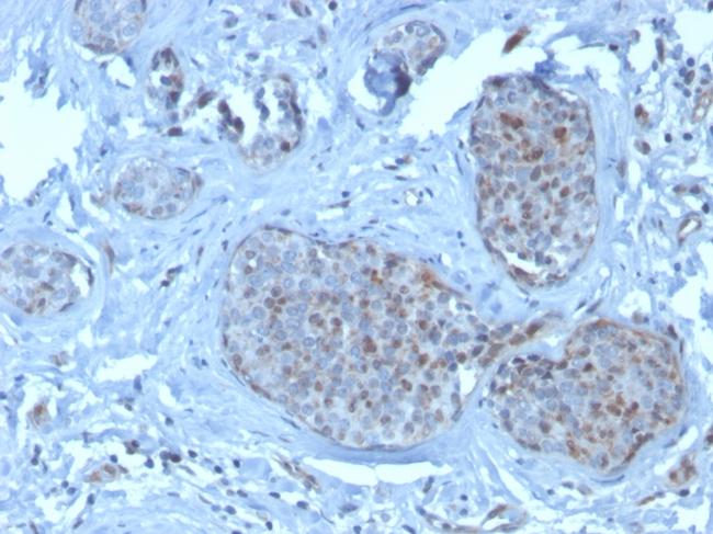 MDM2 Antibody in Immunohistochemistry (Paraffin) (IHC (P))