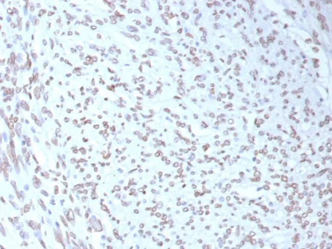 MDM2 Antibody in Immunohistochemistry (Paraffin) (IHC (P))