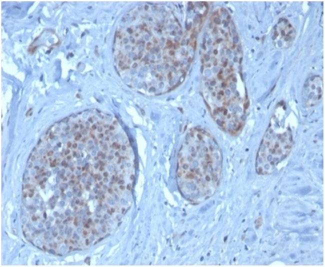 MDM2 Antibody in Immunohistochemistry (Paraffin) (IHC (P))