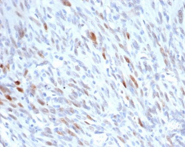 MDM2 Antibody in Immunohistochemistry (Paraffin) (IHC (P))