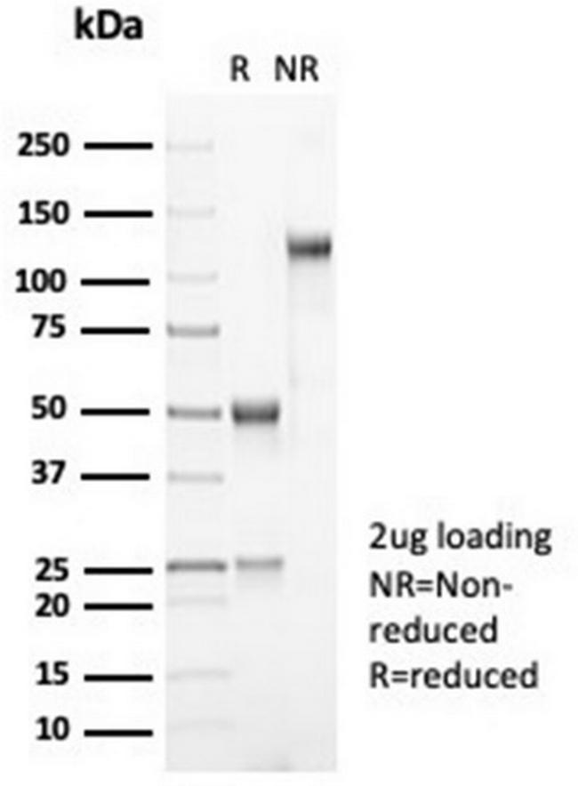 MDM2 Antibody in SDS-PAGE (SDS-PAGE)