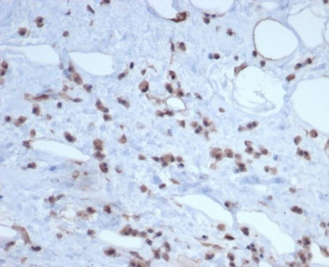 MDM2 Antibody in Immunohistochemistry (Paraffin) (IHC (P))