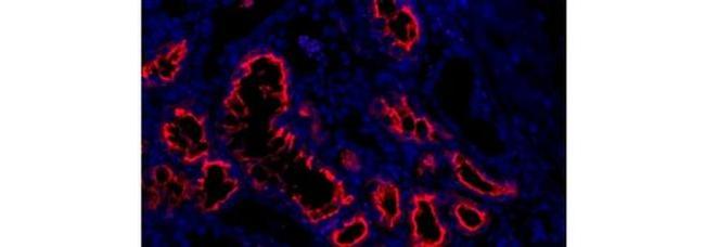 CD15 Antibody in Immunohistochemistry (Paraffin) (IHC (P))