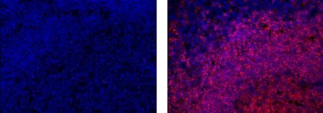 CD20 Antibody in Immunohistochemistry (Paraffin) (IHC (P))