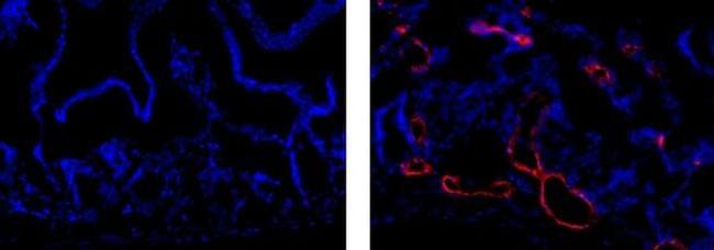 LYVE1 Antibody in Immunohistochemistry (Frozen) (IHC (F))