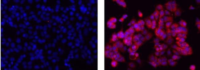 Cytokeratin 7 Antibody in Immunocytochemistry (ICC/IF)