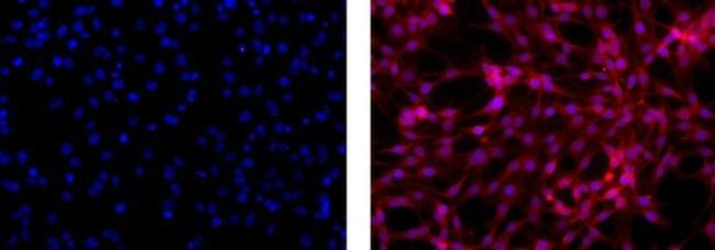 GFAP Antibody in Immunocytochemistry (ICC/IF)