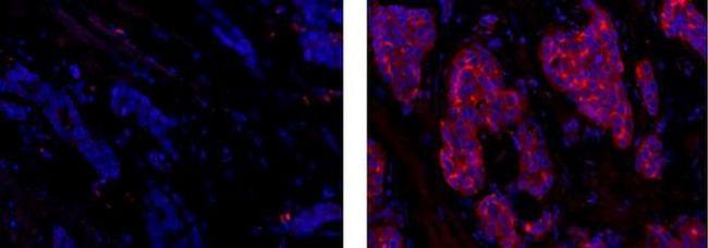 CD227 (Mucin 1) Antibody in Immunohistochemistry (Paraffin) (IHC (P))