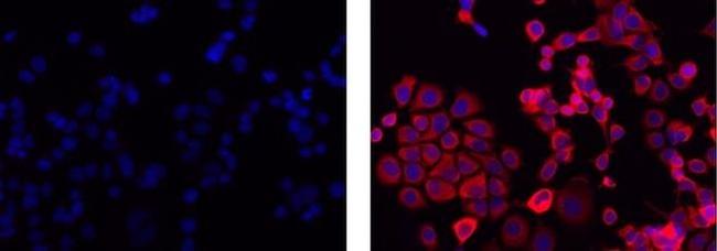 Cytokeratin 19 Antibody in Immunocytochemistry (ICC/IF)