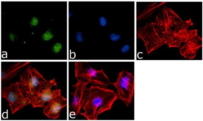 SMAD7 Antibody in Immunocytochemistry (ICC/IF)