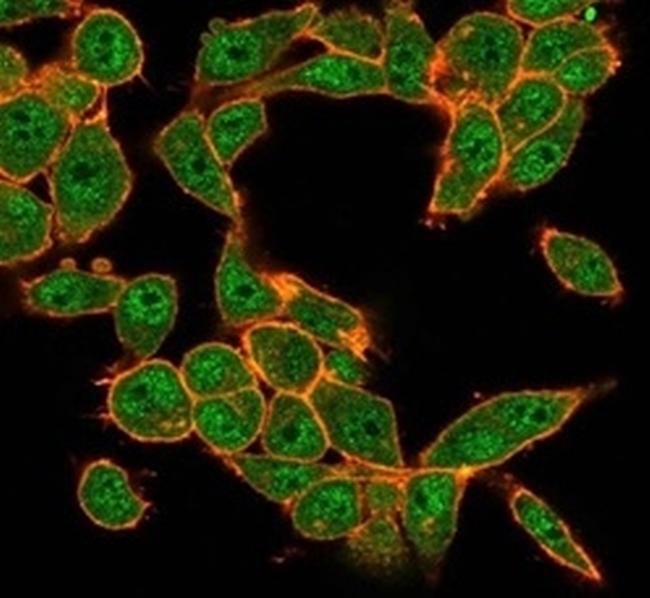 MEF2D/Myocyte enhancer factor 2D (Transcription Factor) Antibody in Immunocytochemistry (ICC/IF)