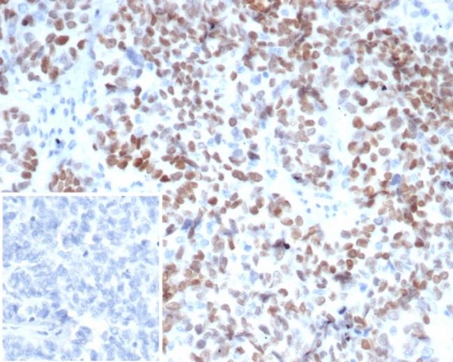 MEIS2 (Transcription Factor) Antibody in Immunohistochemistry (Paraffin) (IHC (P))