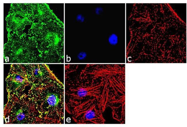 alpha Actinin 4 Antibody in Immunocytochemistry (ICC/IF)