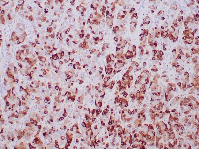 Mammaglobin (SCGB2A2) (Breast Cancer Marker) Antibody in Immunohistochemistry (Paraffin) (IHC (P))