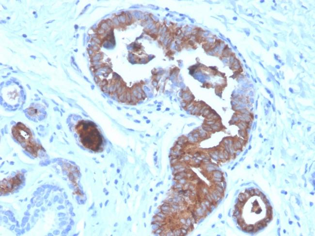 Mammaglobin (SCGB2A2) (Breast Cancer Marker) Antibody in Immunohistochemistry (Paraffin) (IHC (P))