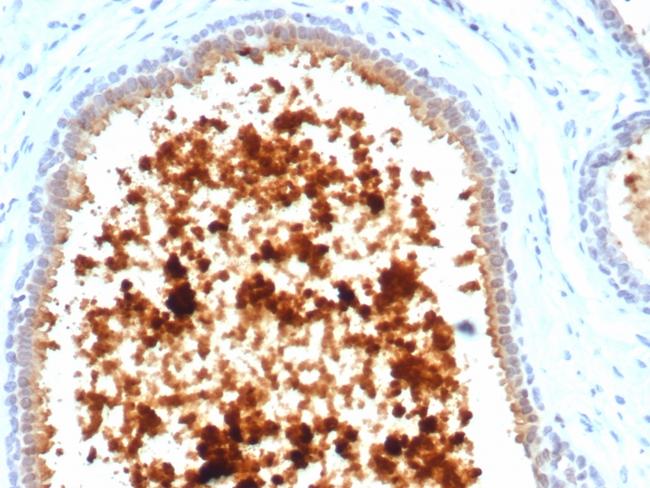 Mammaglobin (SCGB2A2) (Breast Cancer Marker) Antibody in Immunohistochemistry (Paraffin) (IHC (P))