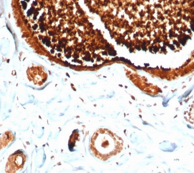 Mammaglobin (SCGB2A2) (Breast Cancer Marker) Antibody in Immunohistochemistry (Paraffin) (IHC (P))