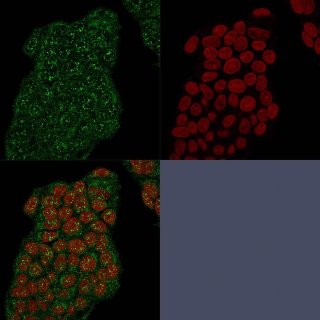 Mammaglobin (SCGB2A2) (Breast Cancer Marker) Antibody in Immunocytochemistry (ICC/IF)