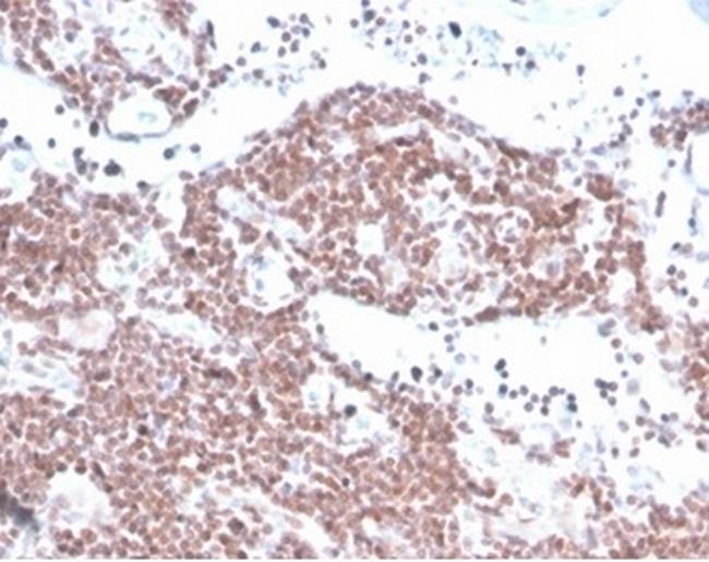 MGMT (Marker of Suppressor of Mutation and Carcinogenesis) Antibody in Immunohistochemistry (Paraffin) (IHC (P))