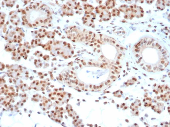 MGMT (Marker of Suppressor of Mutation and Carcinogenesis) Antibody in Immunohistochemistry (Paraffin) (IHC (P))