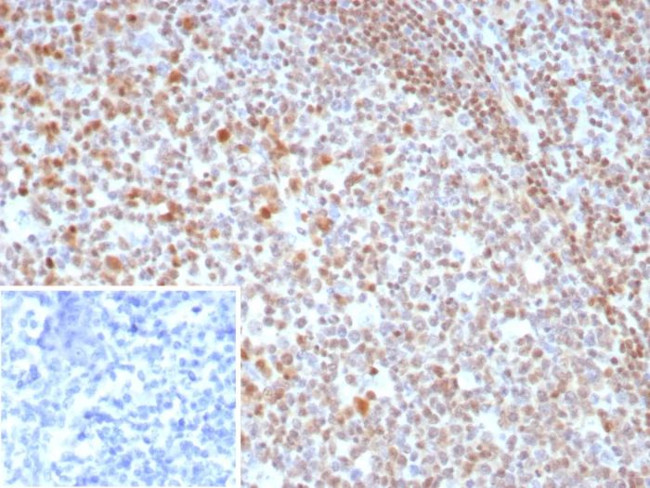 MGMT (Marker of Suppressor of Mutation and Carcinogenesis) Antibody in Immunohistochemistry (Paraffin) (IHC (P))