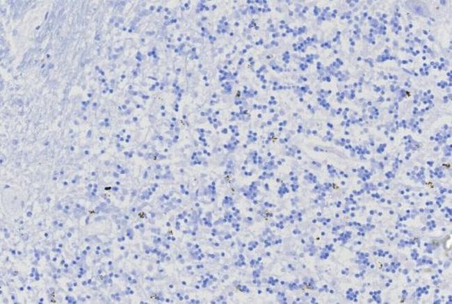 MGMT (Marker of Suppressor of Mutation and Carcinogenesis) Antibody in Immunohistochemistry (Paraffin) (IHC (P))