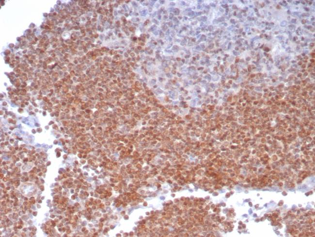 MGMT (Marker of Suppressor of Mutation and Carcinogenesis) Antibody in Immunohistochemistry (Paraffin) (IHC (P))