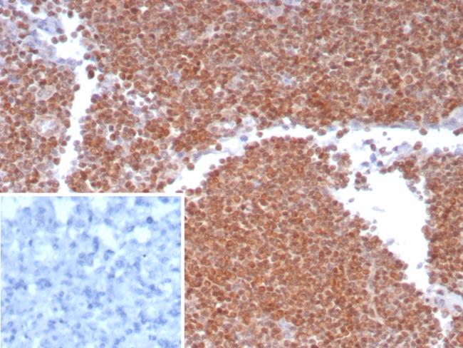 MGMT (Marker of Suppressor of Mutation and Carcinogenesis) Antibody in Immunohistochemistry (Paraffin) (IHC (P))