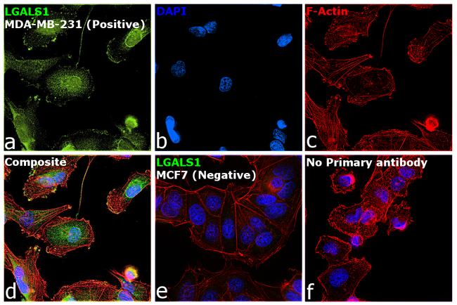 Galectin 1 Antibody in Immunocytochemistry (ICC/IF)