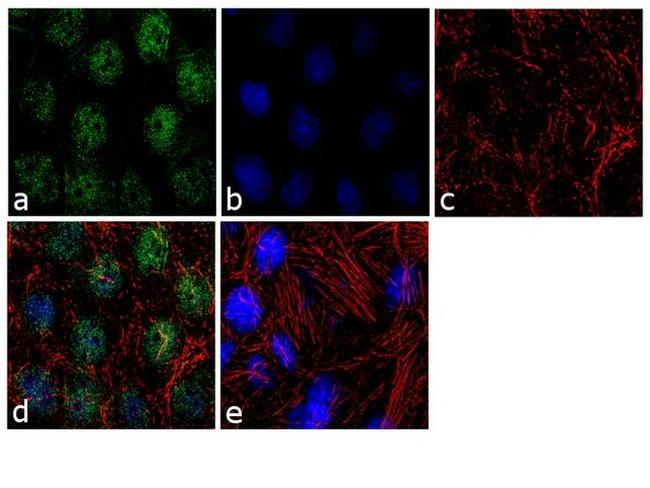 TBX5 Antibody in Immunocytochemistry (ICC/IF)